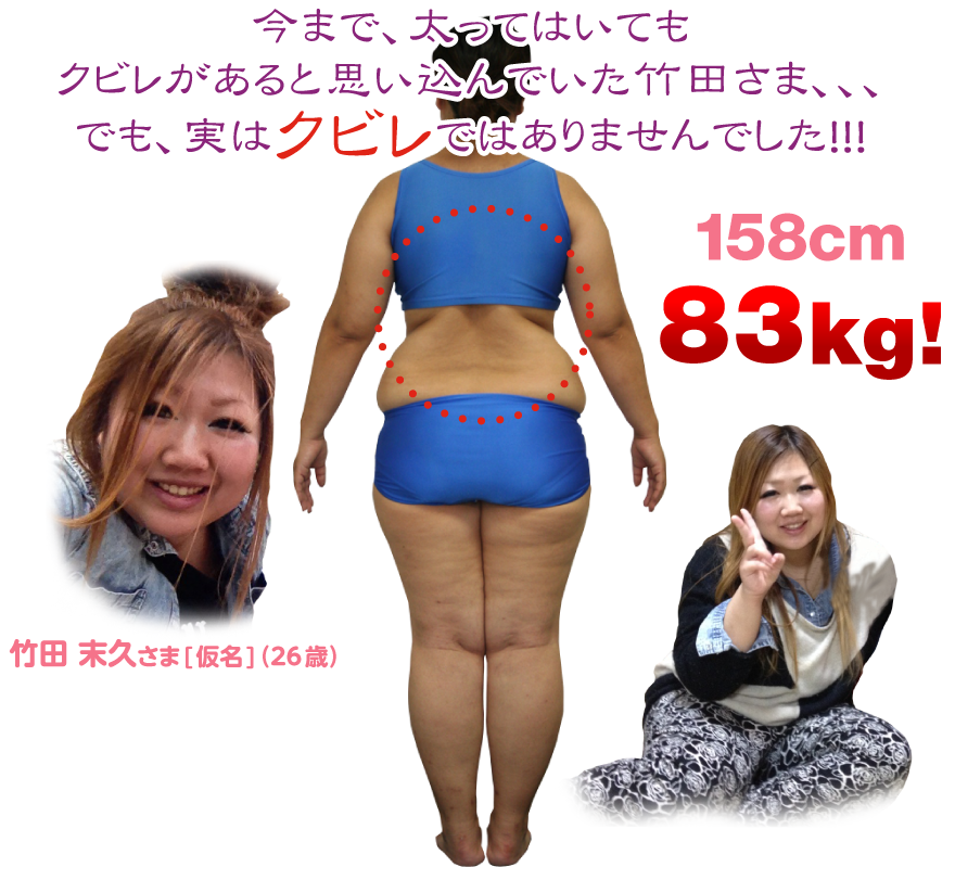 今まで、太ってはいても
クビレがあると思い込んでいた武田さま、、、
でも、実はクビレではありませんでした！！！竹田 末久さま[仮名]（26歳）158cm　83kg!